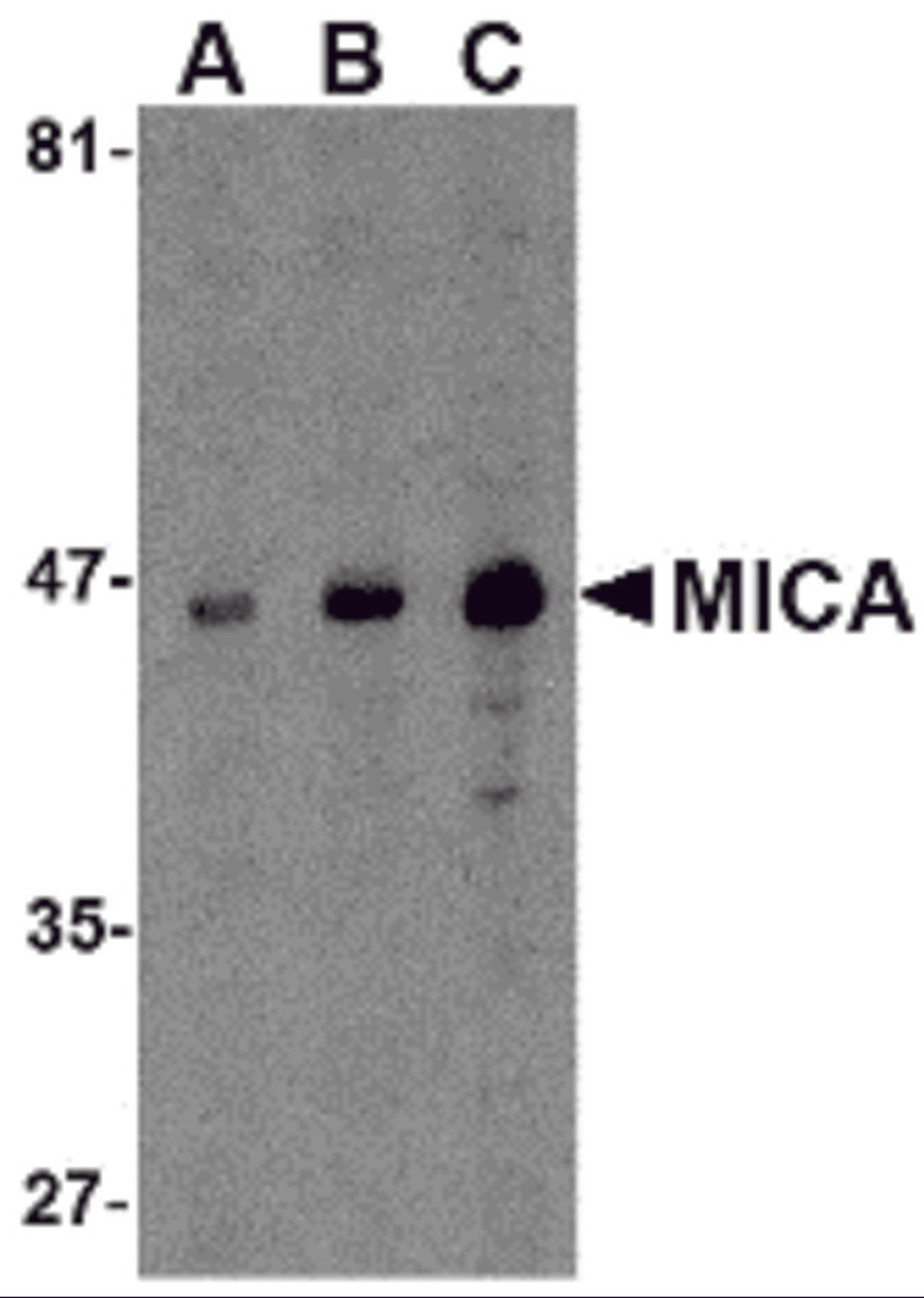 Western blot analysis of MICA in A-20 cell lysate with MICA antibody at (A) 0.5, (B) 1 and (C) 2 μg/mL.