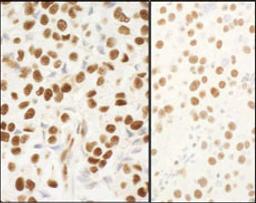 Detection of human and mouse NPM1 by immunohistochemistry.