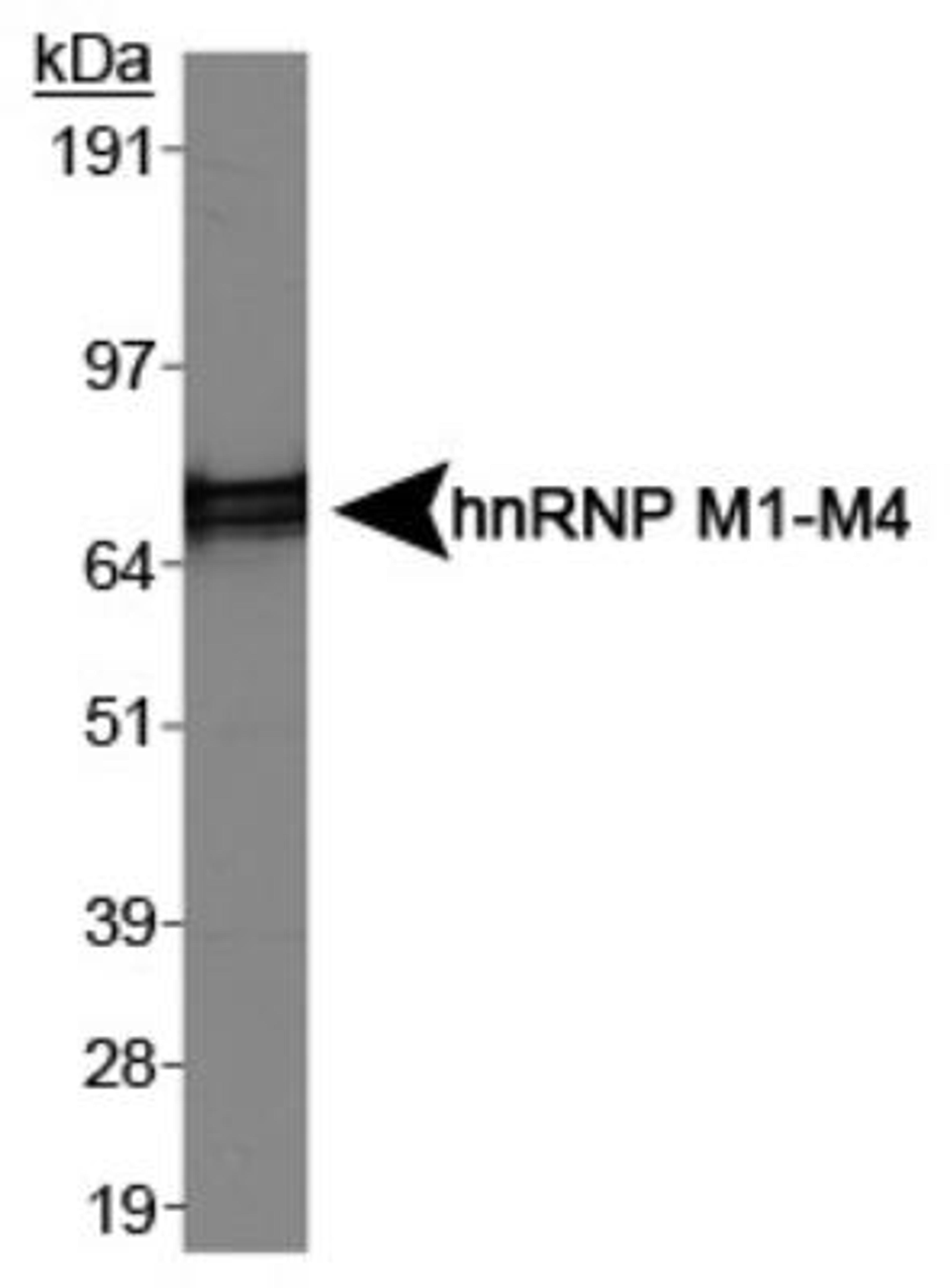 Western Blot: hnRNP M1-M4 Antibody (1D8) [NB200-314] - Analysis of hnRNP M1-M4 in HeLa cell lysates using NB200-314.