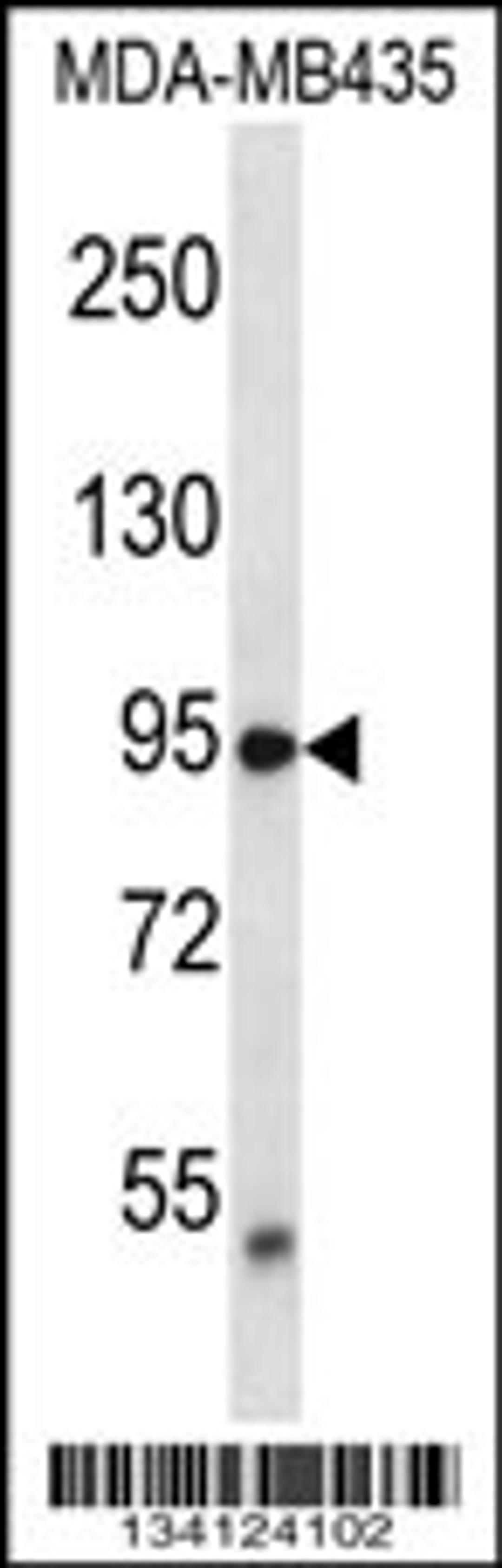 Western blot analysis in MDA-MB435 cell line lysates (35ug/lane).