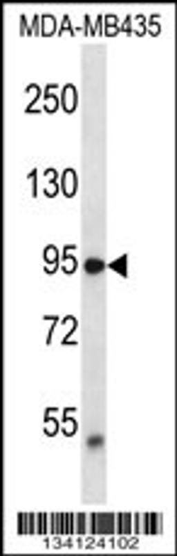 Western blot analysis in MDA-MB435 cell line lysates (35ug/lane).