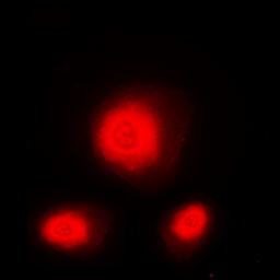 Immunofluorescence analysis of U251 cells using ATXN1 antibody