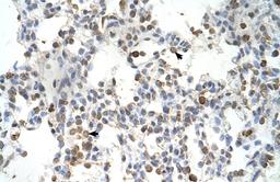 Antibody used in IHC on Human Lung.