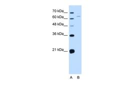 Antibody used in WB on Human Jurkat 0.2-1 ug/ml.