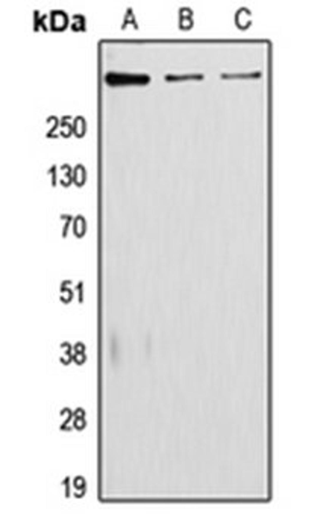 Western blot analysis of JAR (Lane 1), A431 (Lane 2), RAW264.7 (Lane 3) whole cell lysates using LAMA5 antibody