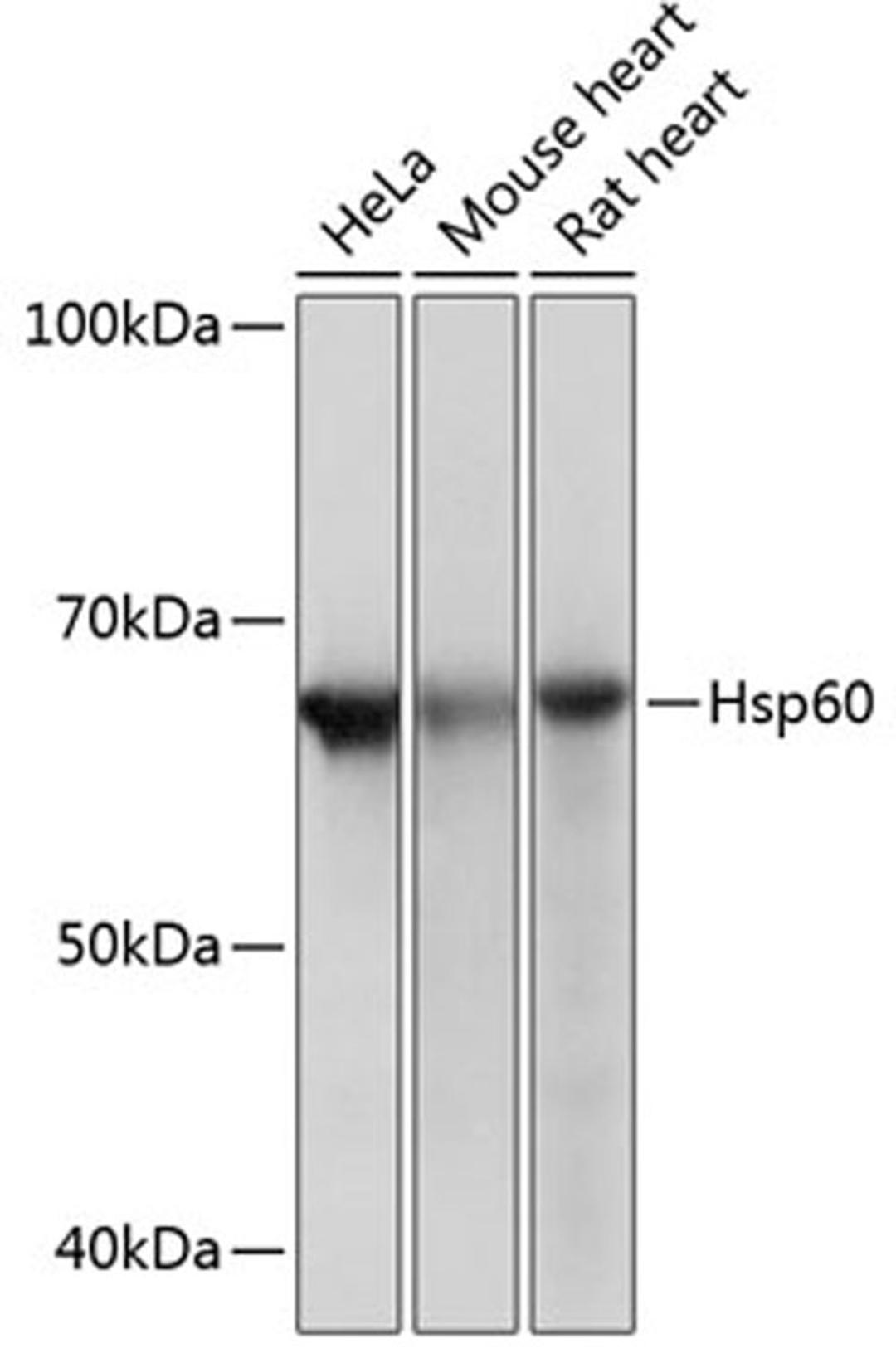 Western blot - Hsp60 Rabbit mAb (A0564)