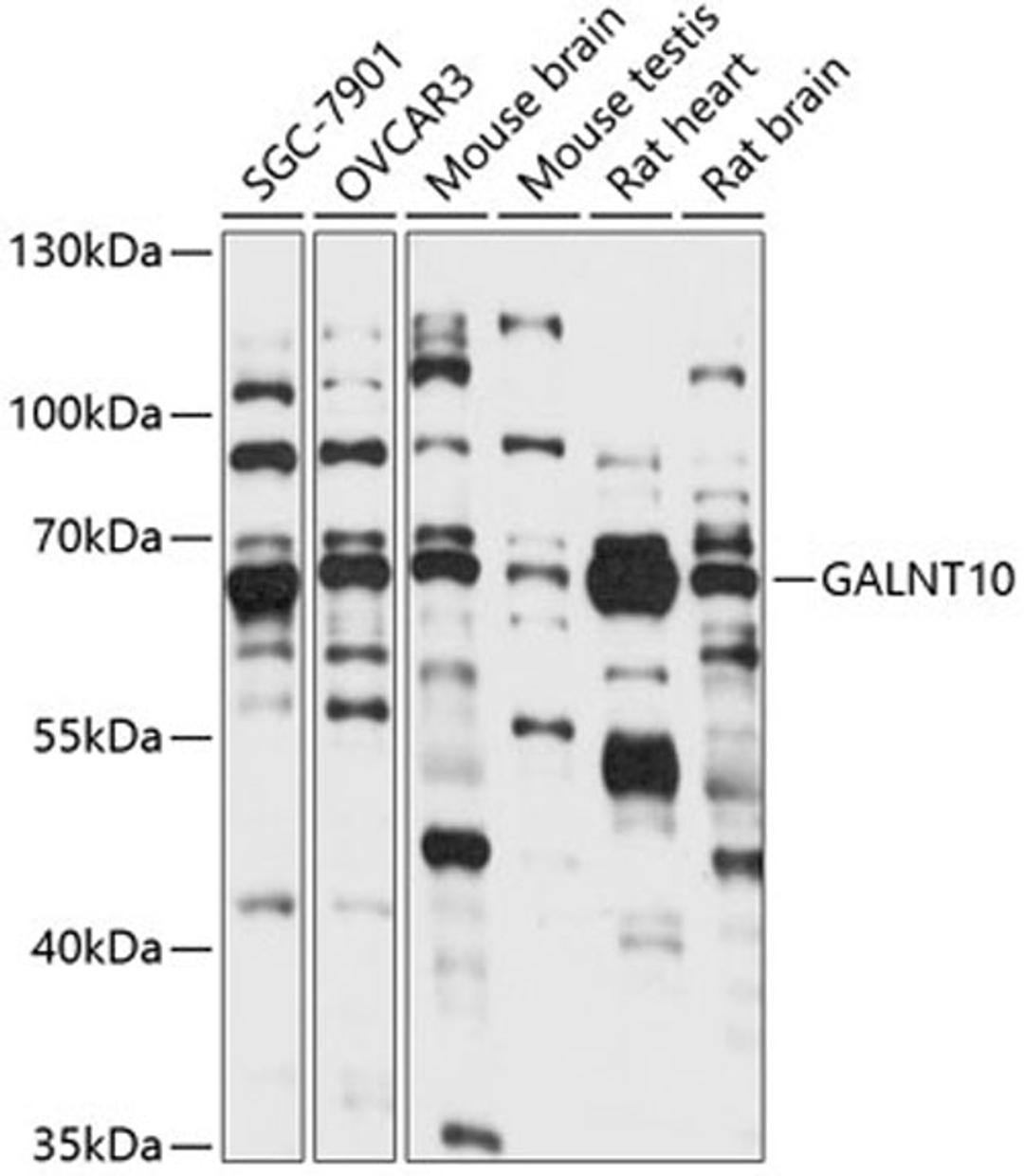 Western blot - GALNT10 antibody (A14909)