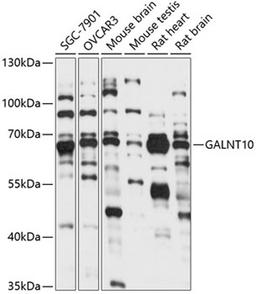 Western blot - GALNT10 antibody (A14909)