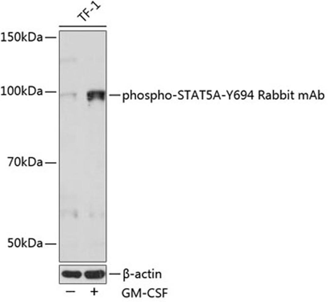 Western blot - Phospho-STAT5A-Y694 Rabbit mAb (AP0758)