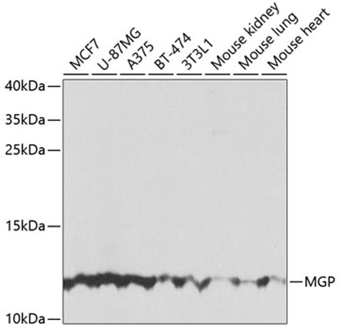 Western blot - MGP antibody (A5439)