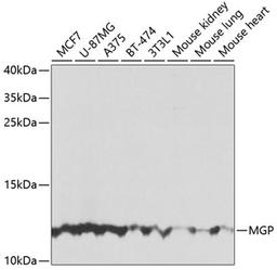 Western blot - MGP antibody (A5439)