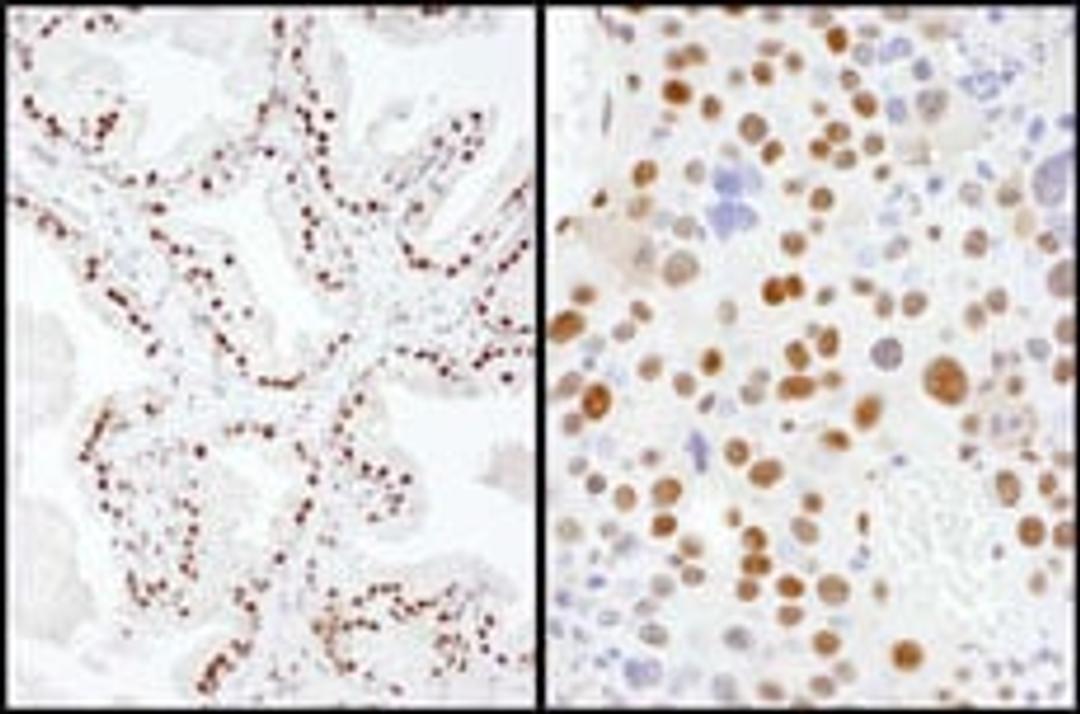 Detection of human and mouse SAE2 by immunohistochemistry.