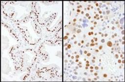 Detection of human and mouse SAE2 by immunohistochemistry.