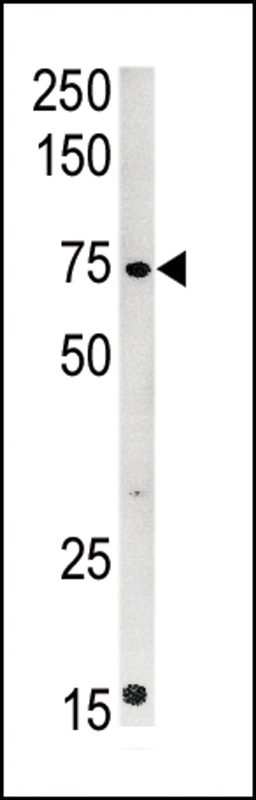 Western blot analysis of anti-CPT2 Pab in mouse kidney tissue lysate (35ug/lane)