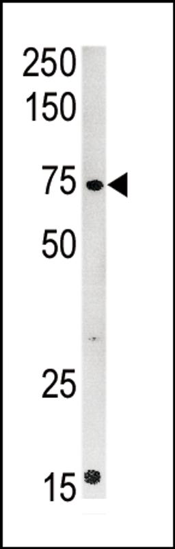 Western blot analysis of anti-CPT2 Pab in mouse kidney tissue lysate (35ug/lane)