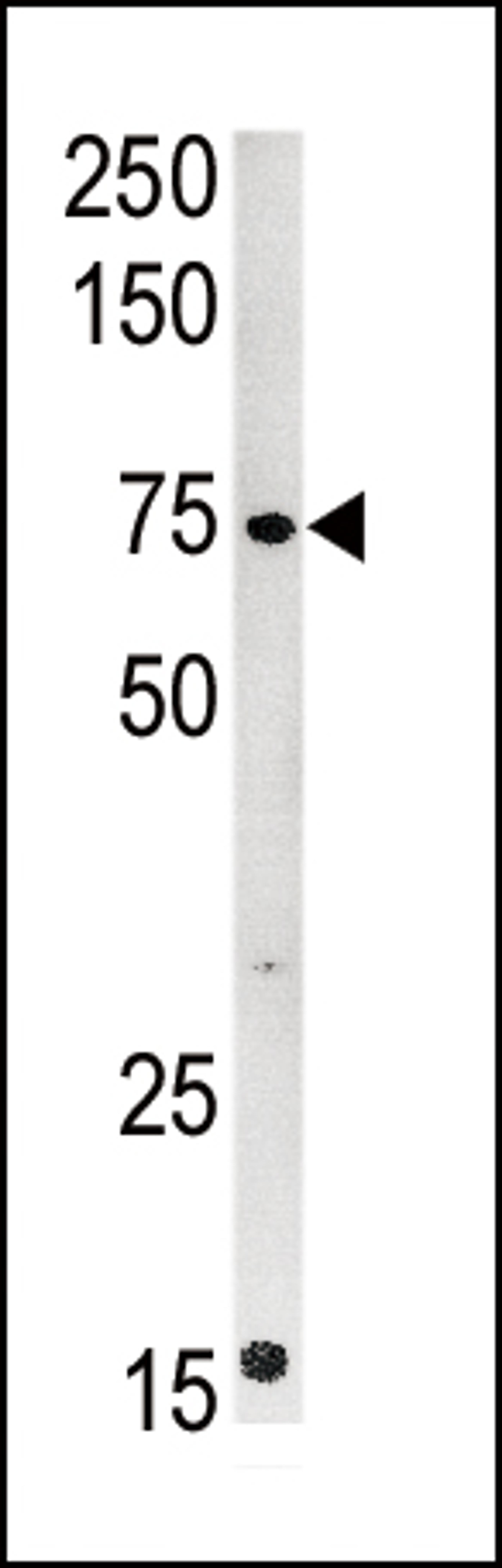 Western blot analysis of anti-CPT2 Pab in mouse kidney tissue lysate (35ug/lane)