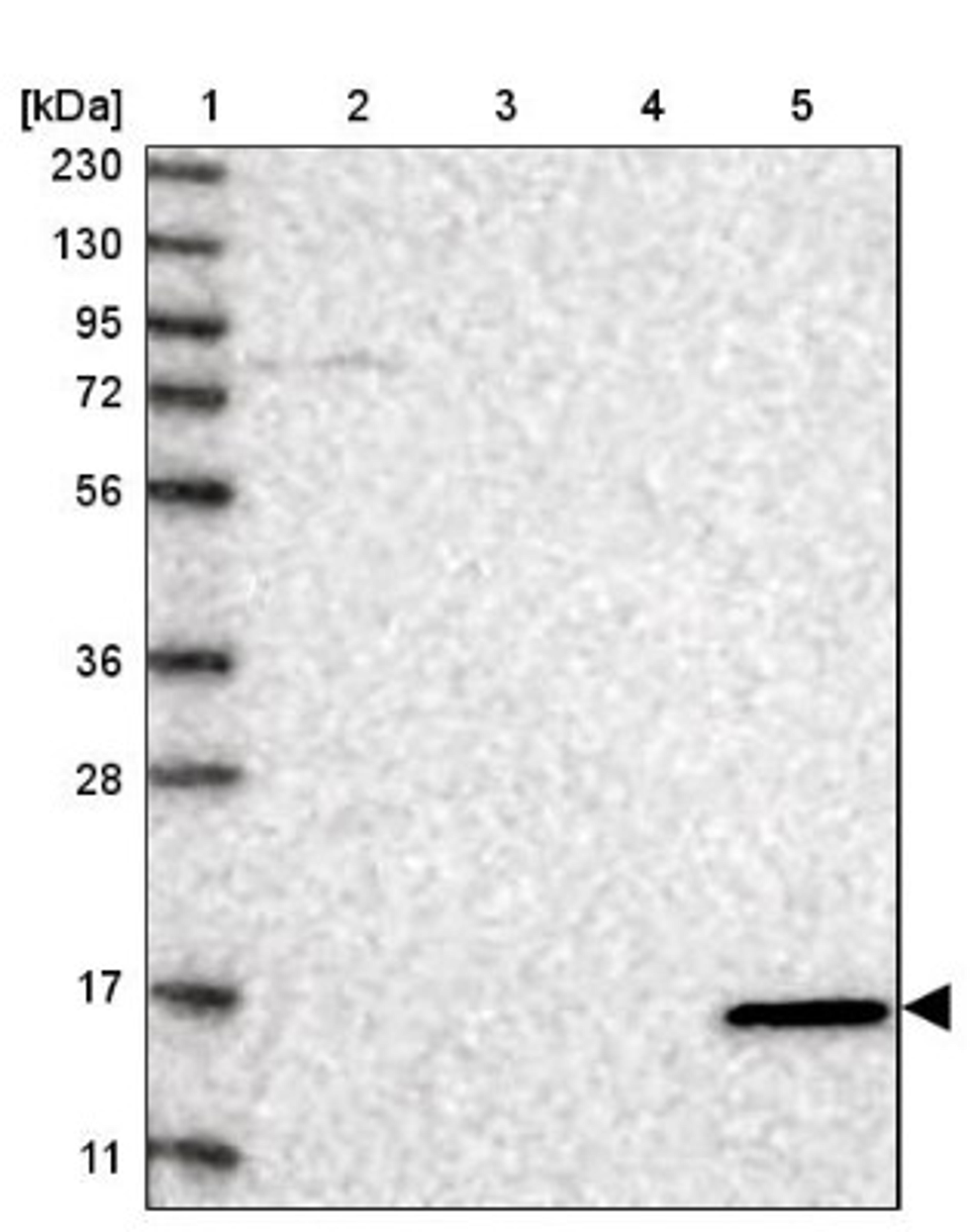 Western Blot: VAMP5 Antibody [NBP1-85913] - Lane 1: Marker [kDa] 230, 130, 95, 72, 56, 36, 28, 17, 11<br/>Lane 2: Human cell line RT-4<br/>Lane 3: Human cell line U-251MG sp<br/>Lane 4: Human plasma (IgG/HSA depleted)<br/>Lane 5: Human liver tissue