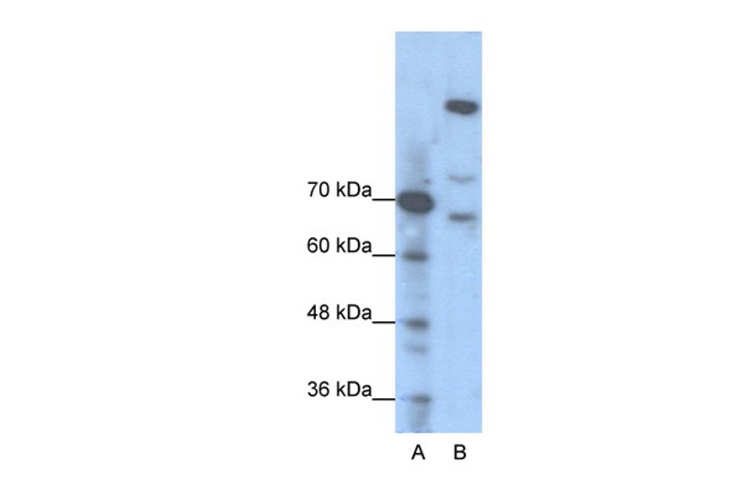 Antibody used in WB on Human Jurkat 1.25 ug/ml.