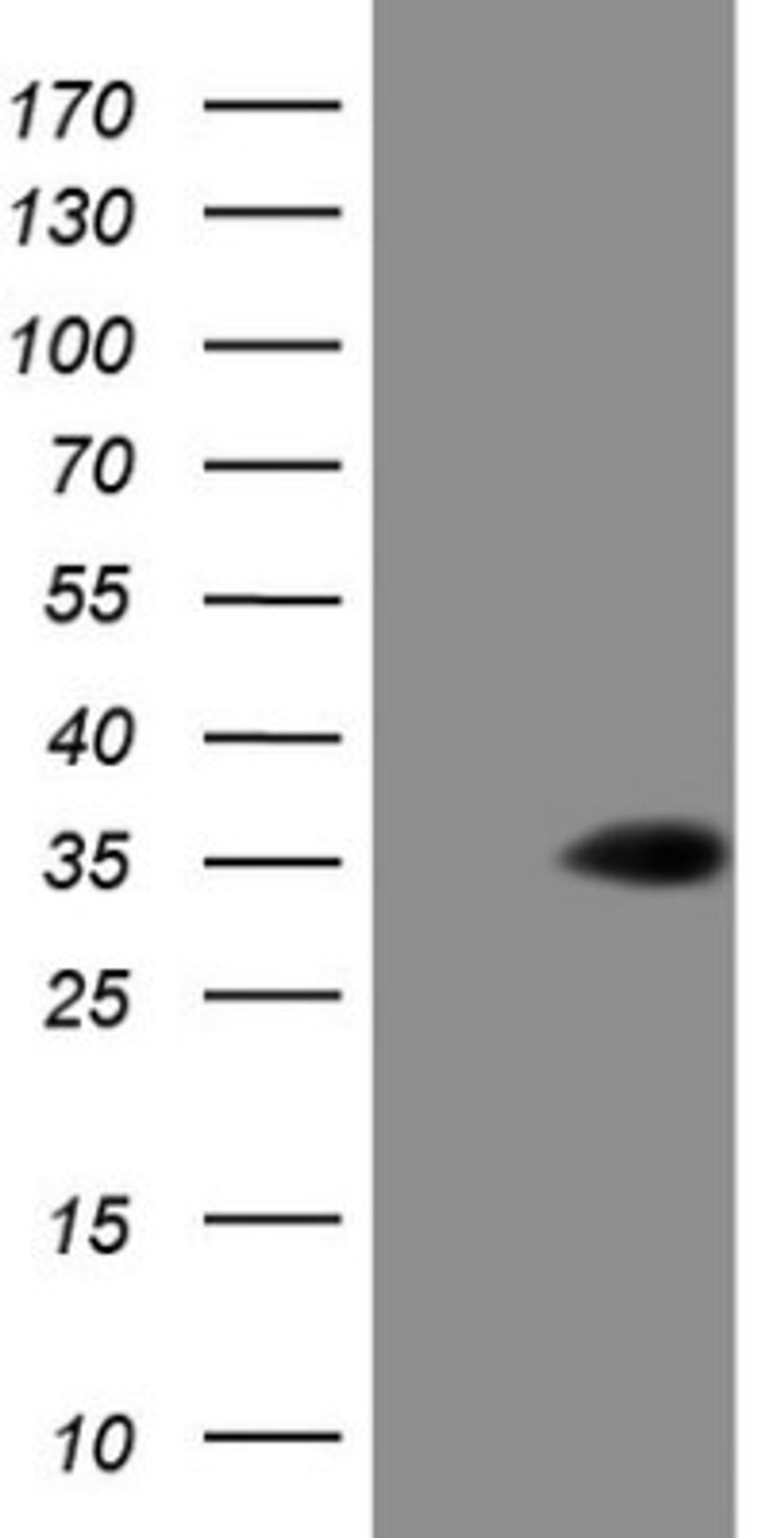 Western Blot: TCEAL1 Antibody (2G10) [NBP2-46085] - Analysis of HEK293T cells were transfected with the pCMV6-ENTRY control (Left lane) or pCMV6-ENTRY TCEAL1.