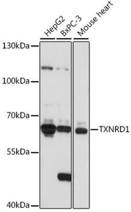 Western blot - TXNRD1 antibody (A16631)