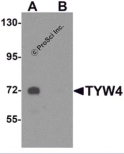 Western blot analysis of TYW4 in rat brain tissue lysate with TYW4 antibody at 1 &#956;g/mL in (A) the absence and (B) the presence of blocking peptide.