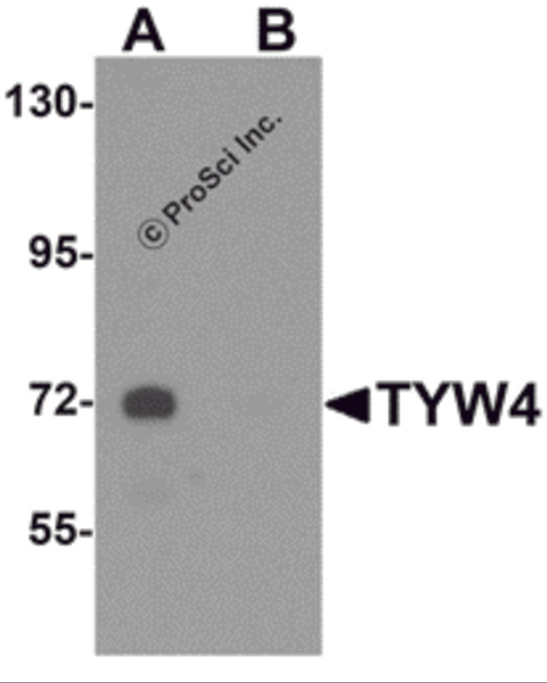 Western blot analysis of TYW4 in rat brain tissue lysate with TYW4 antibody at 1 μg/mL in (A) the absence and (B) the presence of blocking peptide.