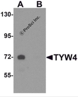 Western blot analysis of TYW4 in rat brain tissue lysate with TYW4 antibody at 1 μg/mL in (A) the absence and (B) the presence of blocking peptide.