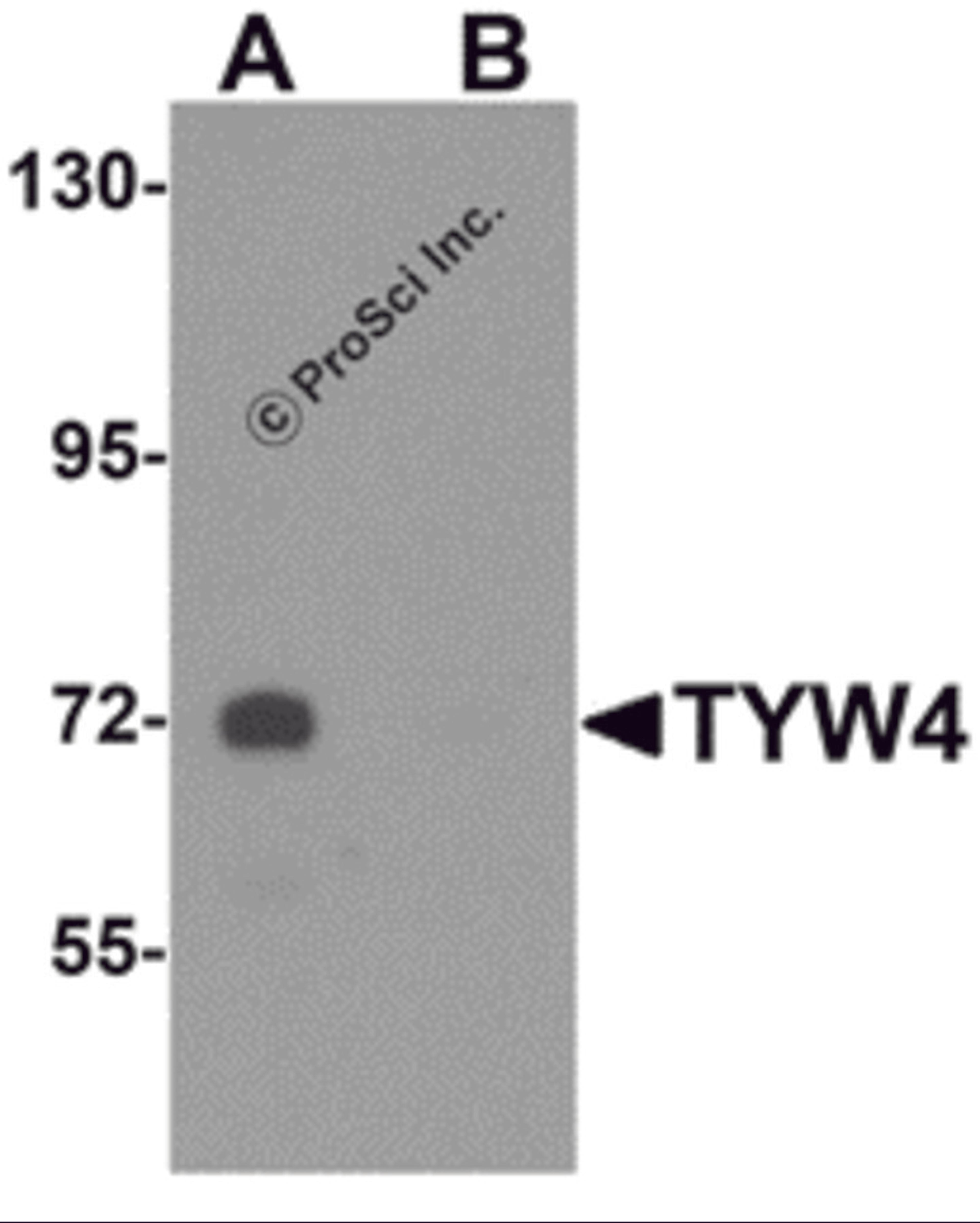 Western blot analysis of TYW4 in rat brain tissue lysate with TYW4 antibody at 1 μg/mL in (A) the absence and (B) the presence of blocking peptide.