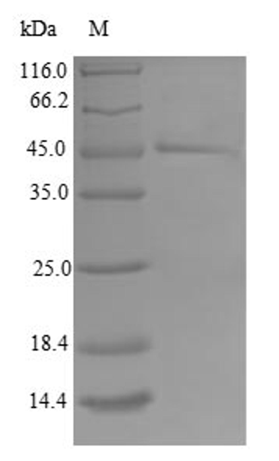 (Tris-Glycine gel) Discontinuous SDS-PAGE (reduced) with 5% enrichment gel and 15% separation gel.