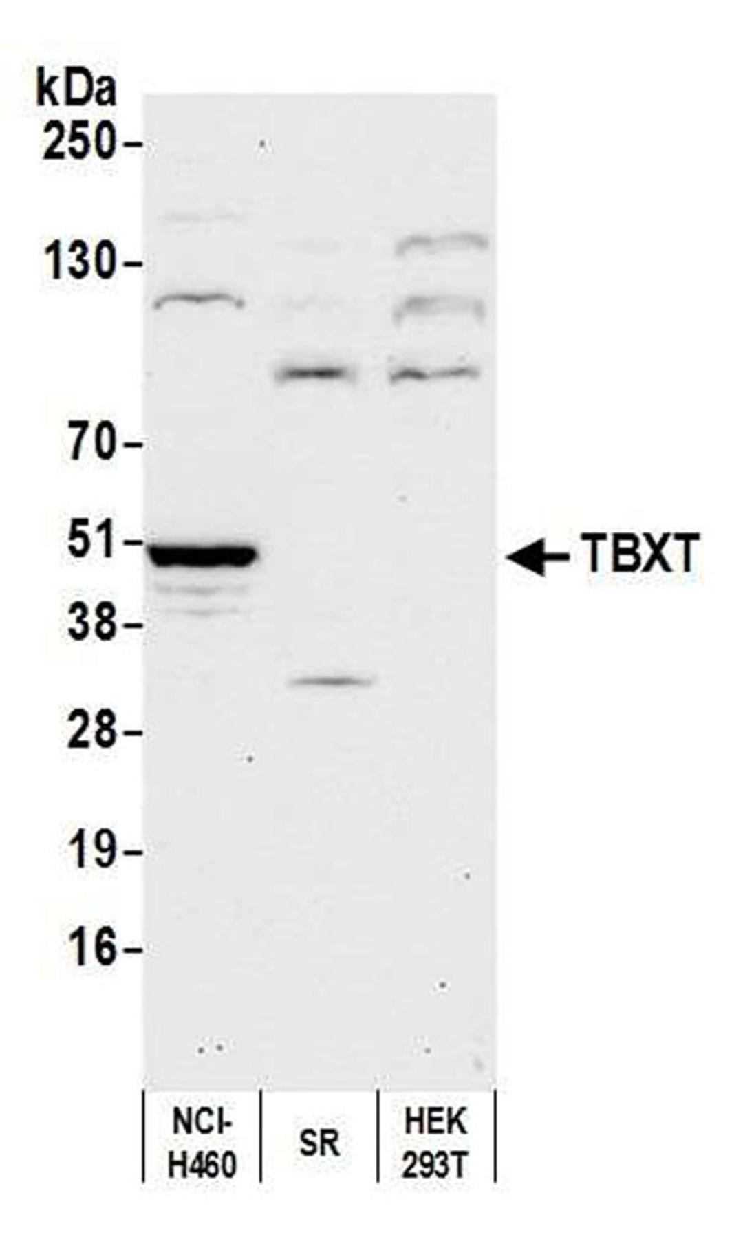 Detection of human TBXT by WB.