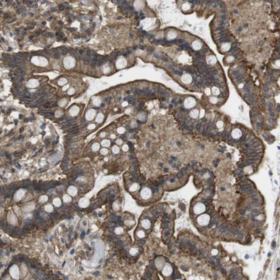 Immunohistochemistry-Paraffin: ZDHHC5 Antibody [NBP1-81376] - Staining of human colon shows strong membranous positivity in glandular cells.