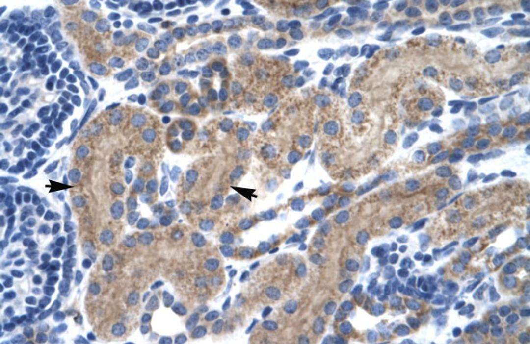 Antibody used in IHC on Human kidney.