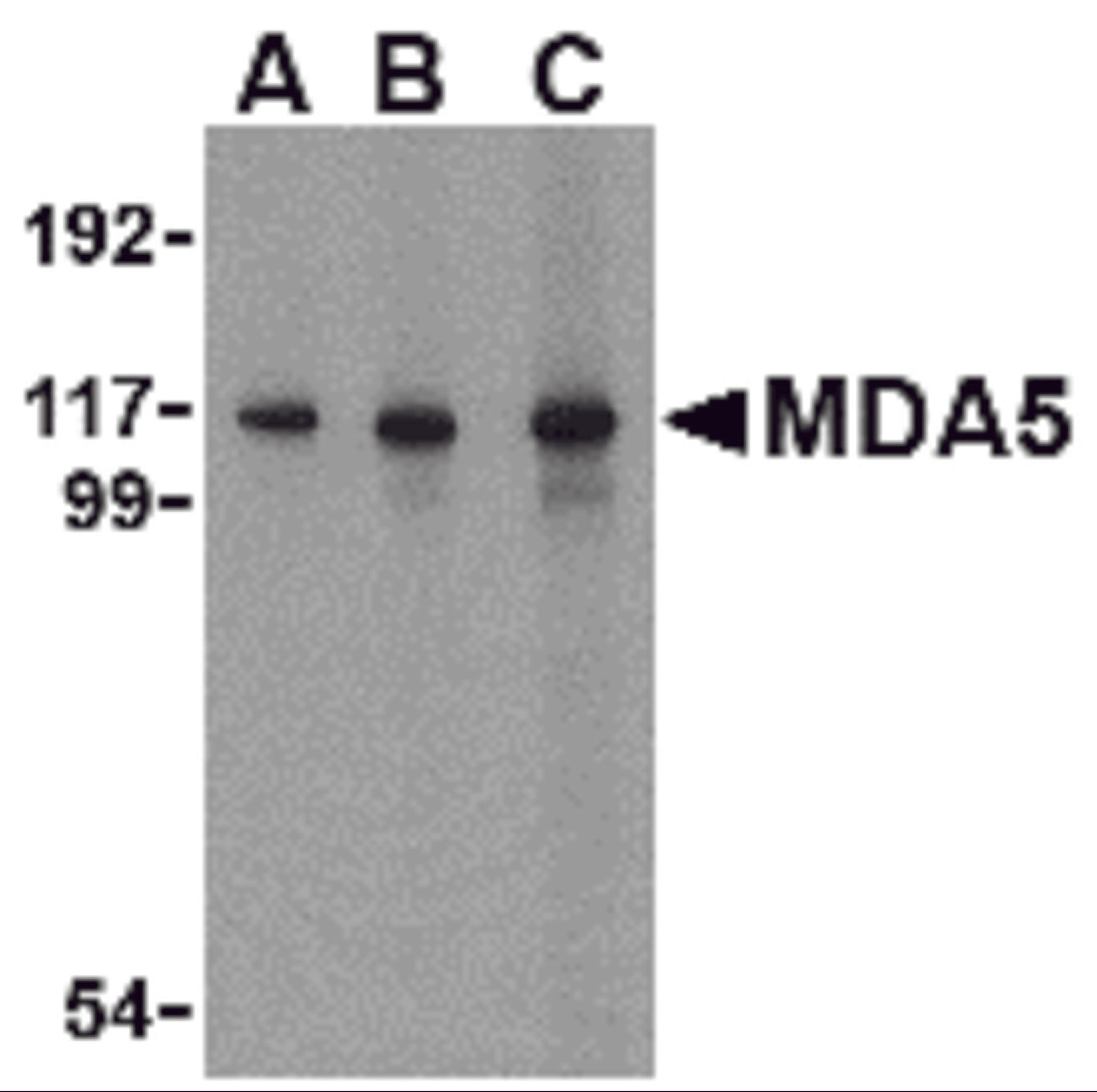 Western blot analysis of MDA5 in Daudi cell lysate with MDA5 antibody at (A) 1, (B) 2 and (C) 4 &#956;g/mL.