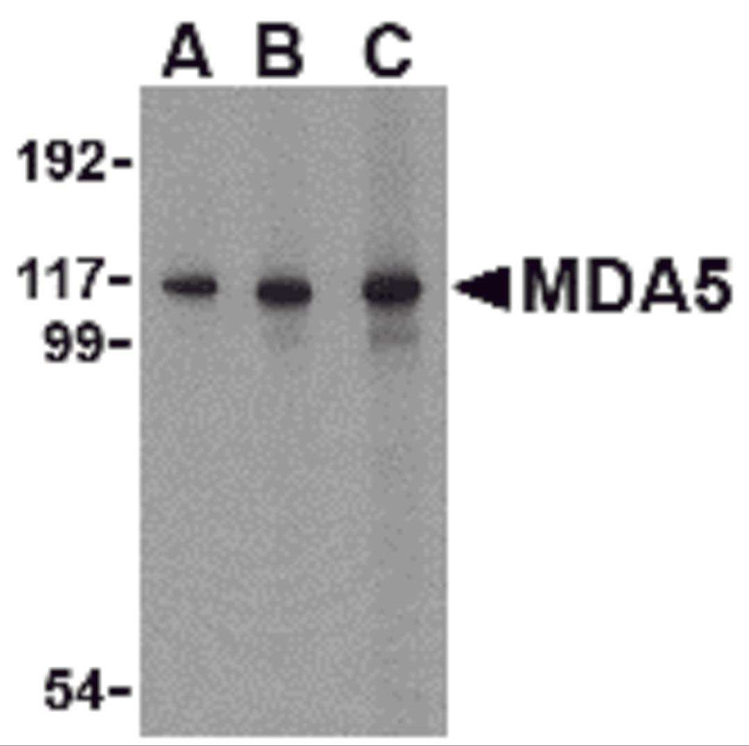 Western blot analysis of MDA5 in Daudi cell lysate with MDA5 antibody at (A) 1, (B) 2 and (C) 4 μg/mL.