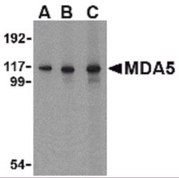 Western blot analysis of MDA5 in Daudi cell lysate with MDA5 antibody at (A) 1, (B) 2 and (C) 4 μg/mL.