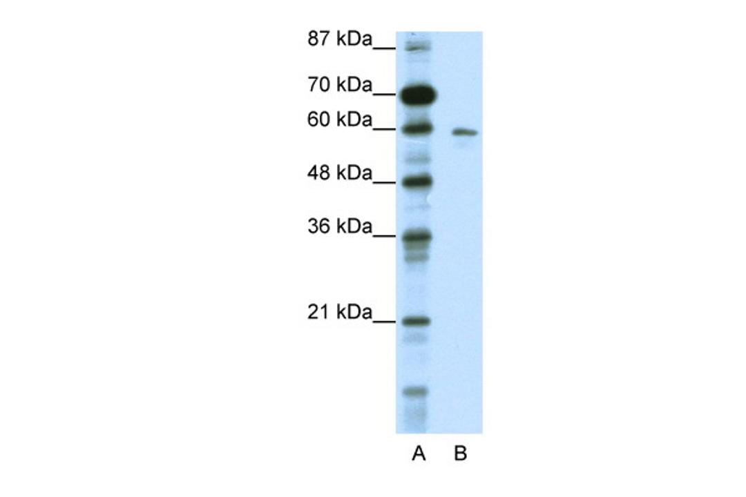 Antibody used in WB on Human HepG2 at 0.2-1 ug/ml.