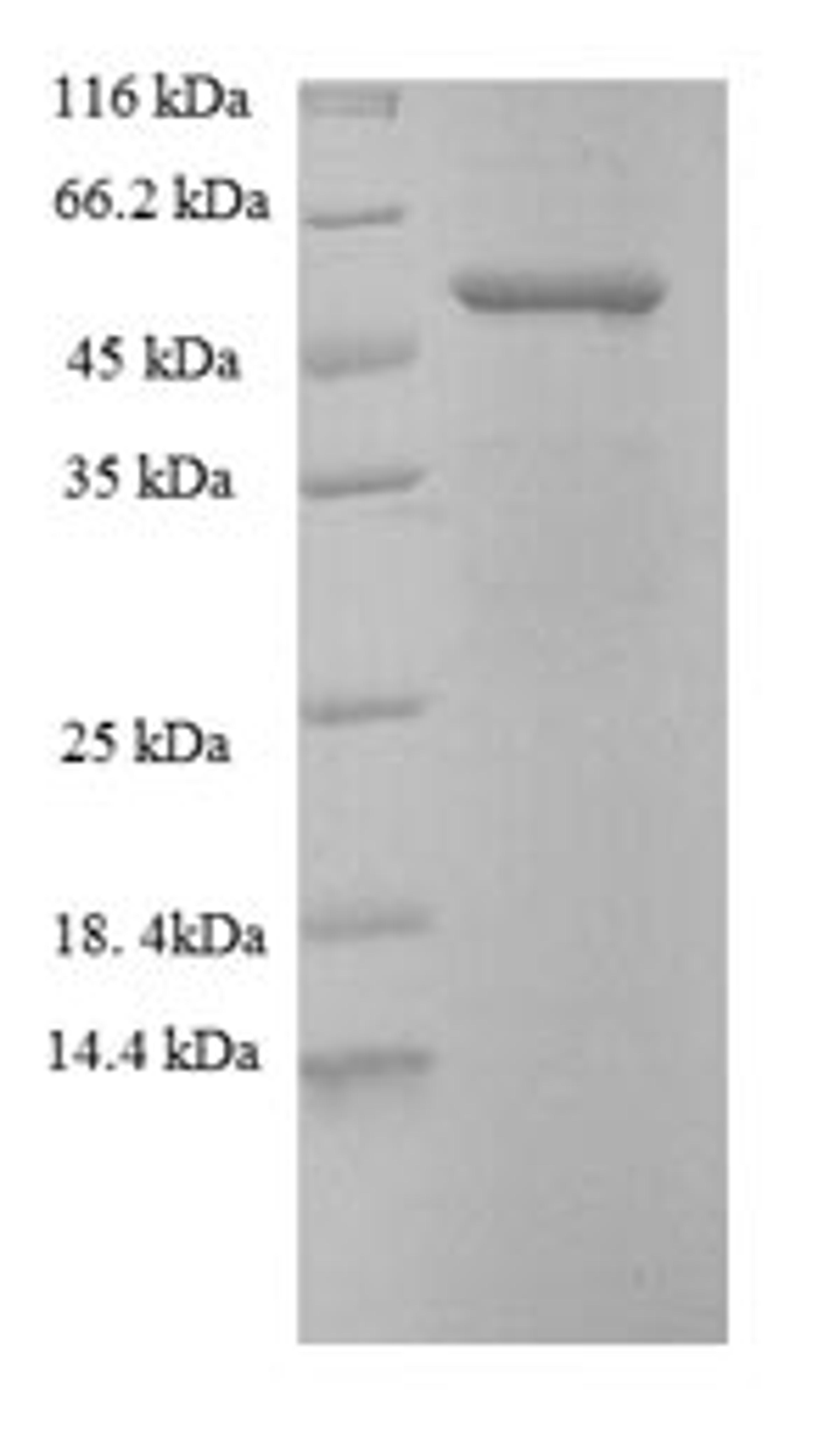 (Tris-Glycine gel) Discontinuous SDS-PAGE (reduced) with 5% enrichment gel and 15% separation gel.