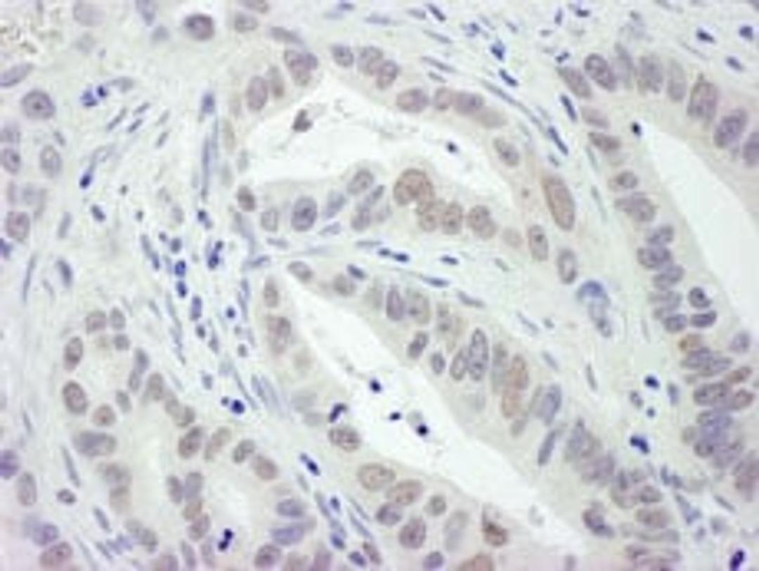 Detection of human RPA32 by immunohistochemistry.