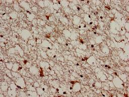Immunohistochemistry analysis of human brain tissue using CSB-PA891796LA01HU at dilution of 1:100