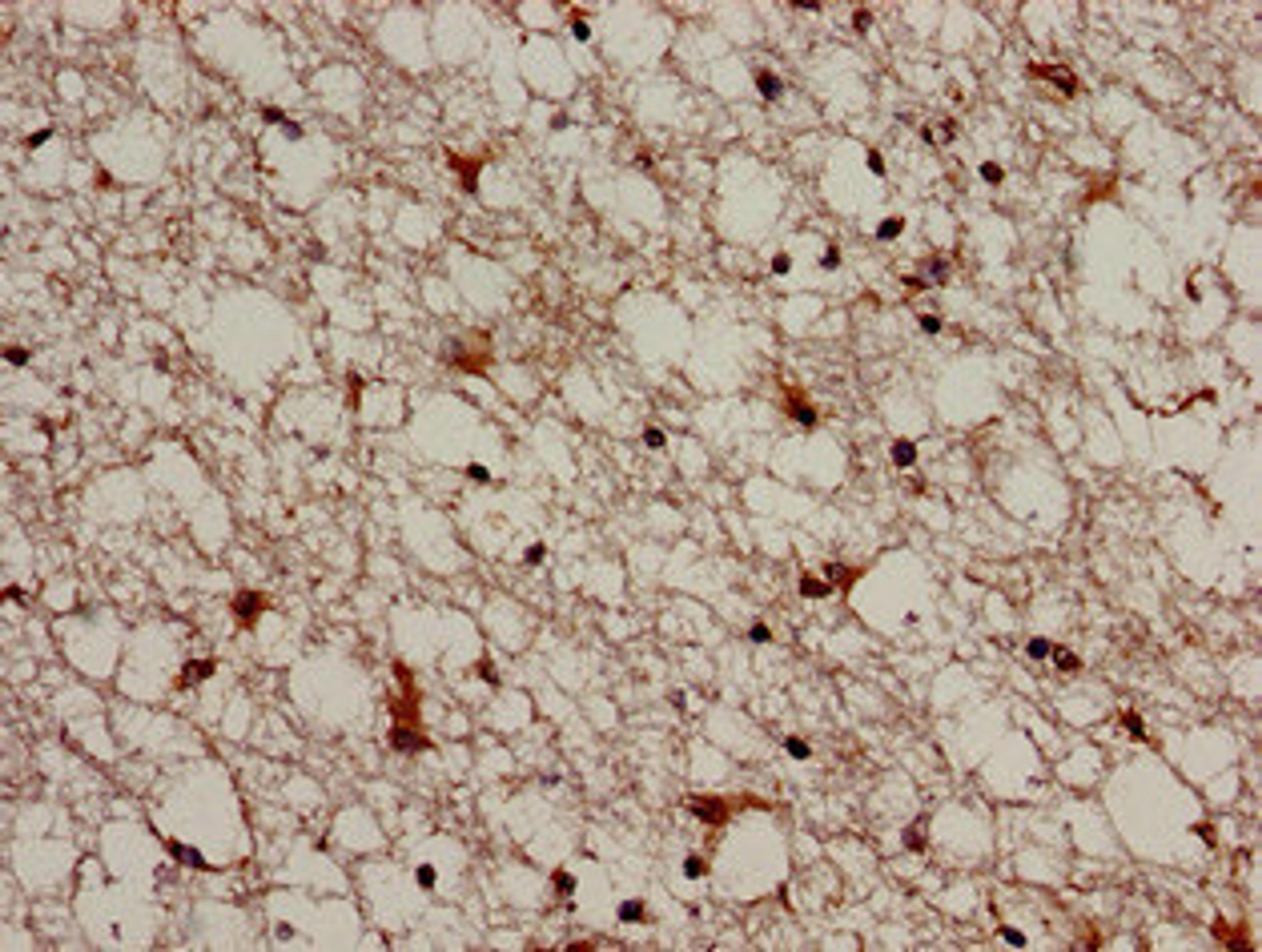 Immunohistochemistry analysis of human brain tissue using CSB-PA891796LA01HU at dilution of 1:100