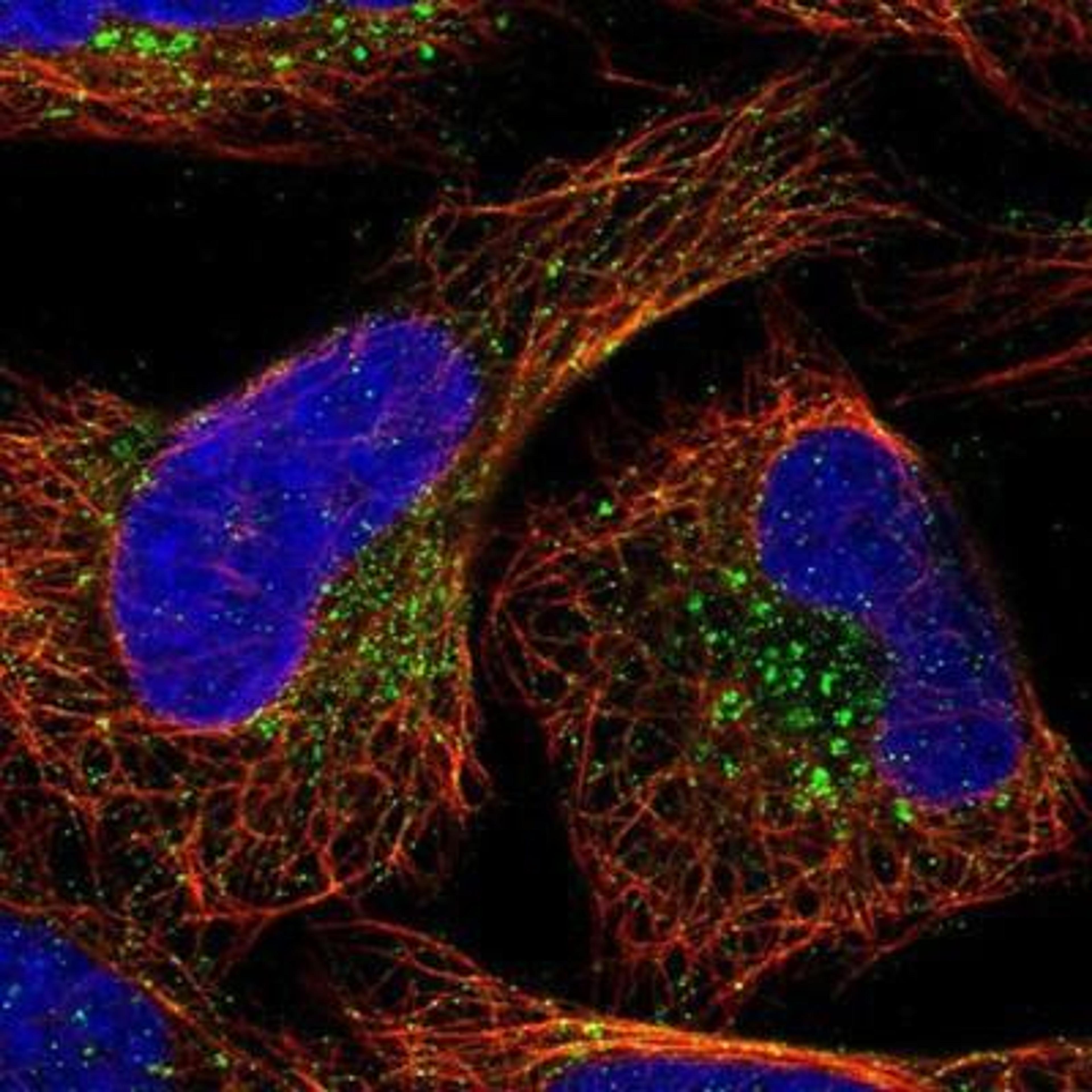 Immunocytochemistry/Immunofluorescence: DRAM2 Antibody [NBP1-93463] - Staining of human cell line U-2 OS shows positivity in golgi apparatus & vesicles.