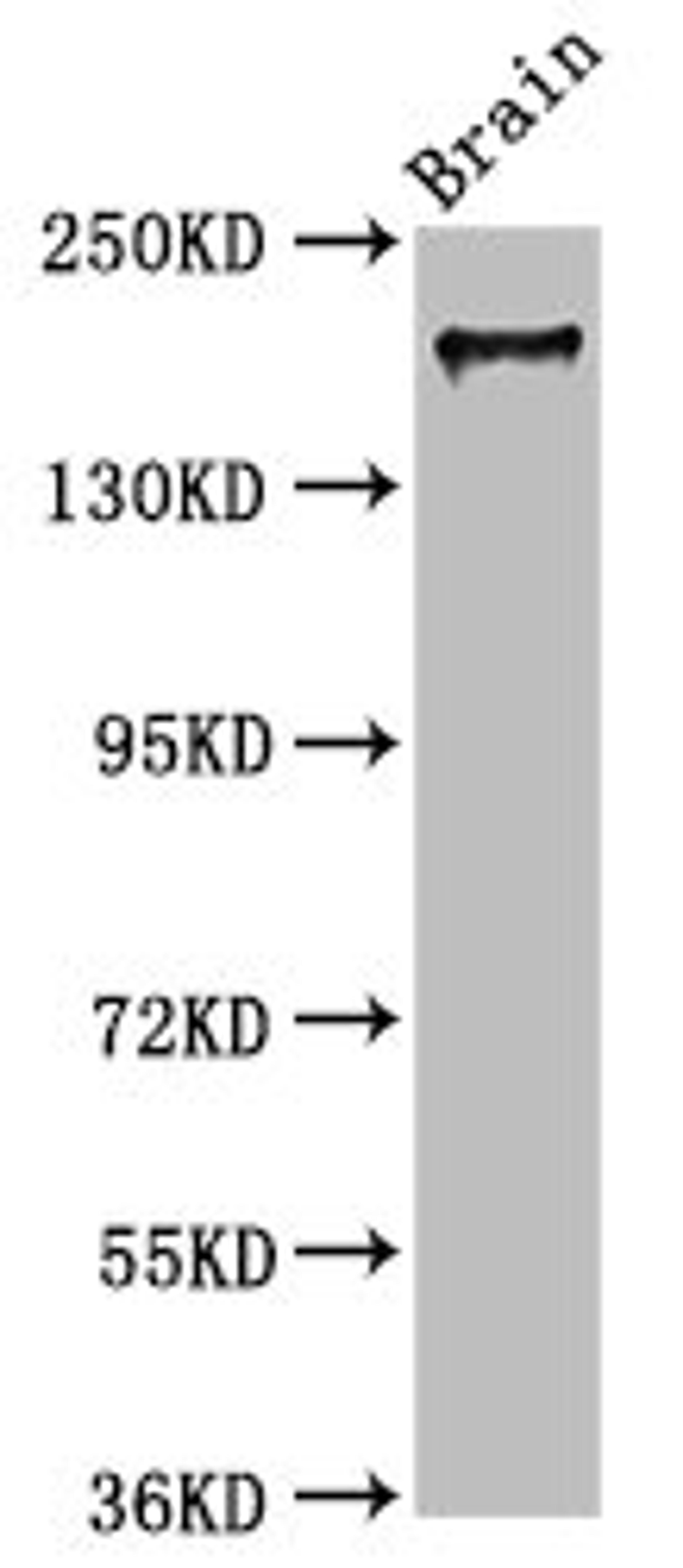 Western Blot. Positive WB detected in: Mouse brain tissue. All lanes: MYO5A antibody at 7.3ug/ml. Secondary. Goat polyclonal to rabbit IgG at 1/50000 dilution. Predicted band size: 216, 213, 219 kDa. Observed band size: 216 kDa.