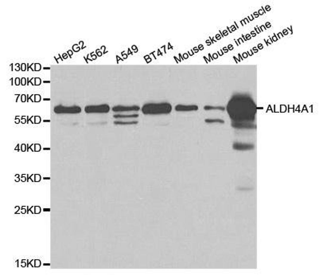 Western blot analysis of extracts of various cell lines using ALDH4A1 antibody