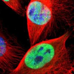 Immunocytochemistry/Immunofluorescence: CSTF2T Antibody [NBP1-87407] - Staining of human cell line U-251MG shows positivity in nuclei but not nucleoli.