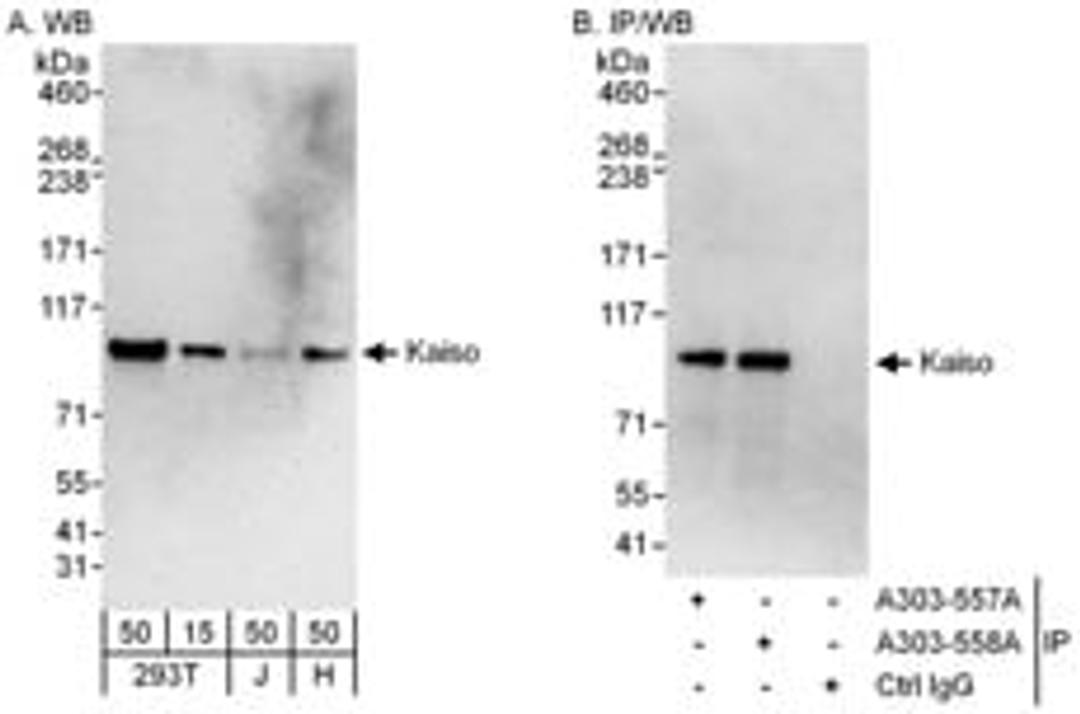 Detection of human Kaiso by western blot and immunoprecipitation.