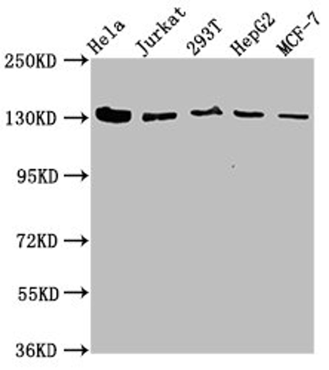 Western Blot. Positive WB detected in: Hela whole cell lysate, Jurkat whole cell lysate, 293T whole cell lysate, HepG2 whole cell lysate, MCF-7 whole cell lysate. All lanes: CAND1 antibody at 4.9µg/ml. Secondary. Goat polyclonal to rabbit IgG at 1/50000 dilution. Predicted band size: 137, 118, 46 kDa. Observed band size: 137 kDa