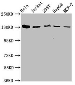 Western Blot. Positive WB detected in: Hela whole cell lysate, Jurkat whole cell lysate, 293T whole cell lysate, HepG2 whole cell lysate, MCF-7 whole cell lysate. All lanes: CAND1 antibody at 4.9µg/ml. Secondary. Goat polyclonal to rabbit IgG at 1/50000 dilution. Predicted band size: 137, 118, 46 kDa. Observed band size: 137 kDa