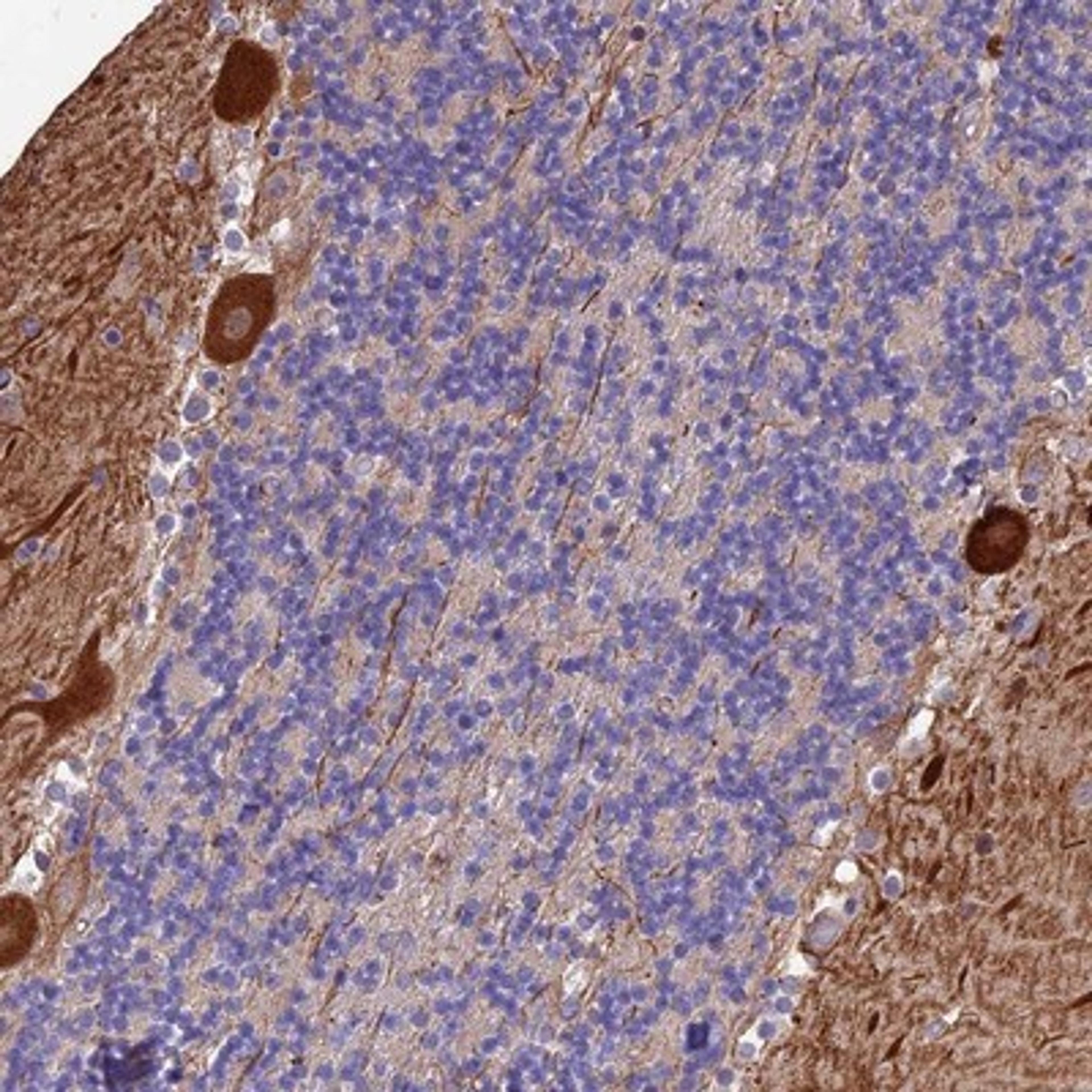 Immunohistochemistry-Paraffin: MFSD2 Antibody [NBP1-92112] - Staining of human cerebellum shows strong cytoplasmic positivity in Purkinje cells.