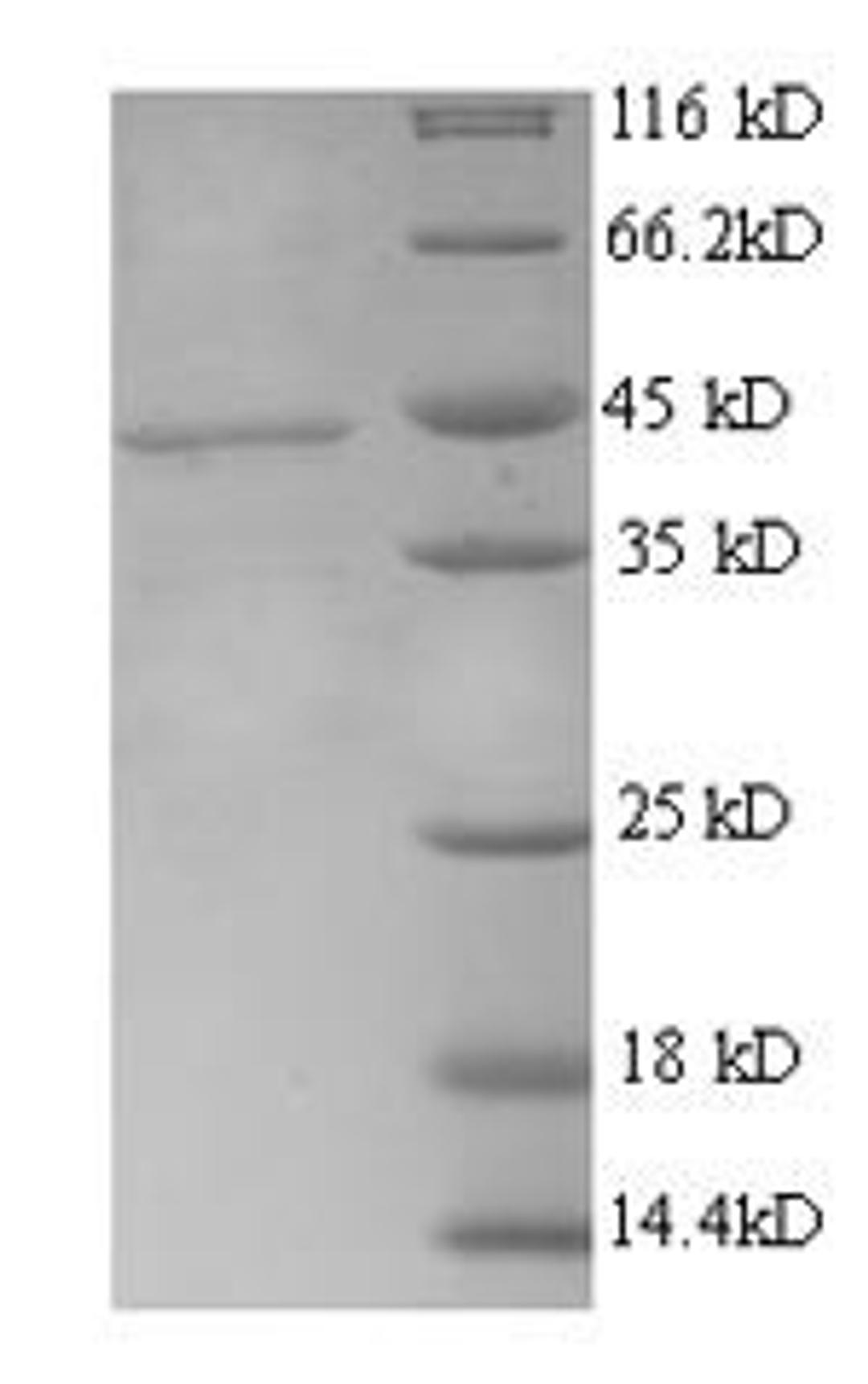 (Tris-Glycine gel) Discontinuous SDS-PAGE (reduced) with 5% enrichment gel and 15% separation gel.