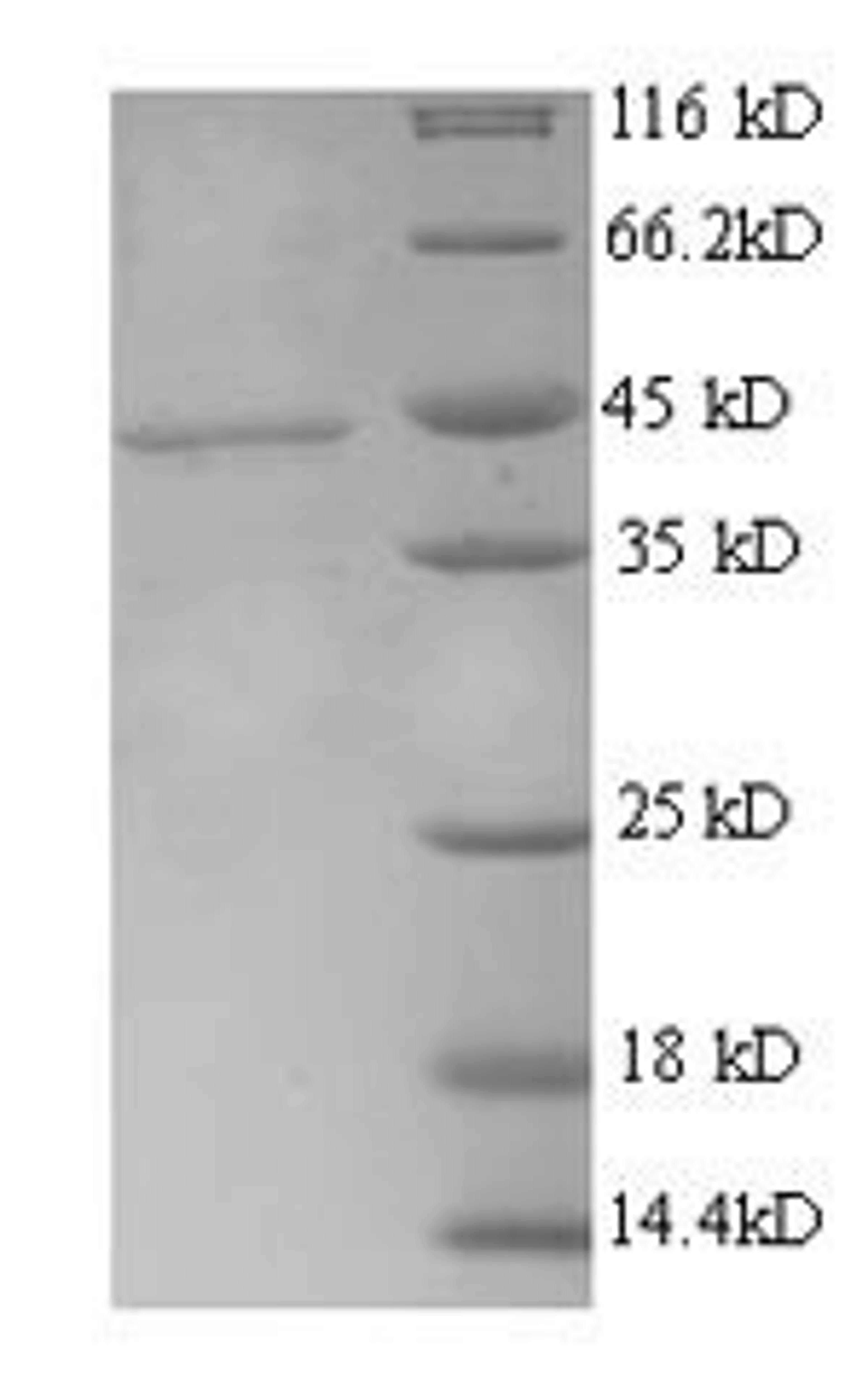 (Tris-Glycine gel) Discontinuous SDS-PAGE (reduced) with 5% enrichment gel and 15% separation gel.